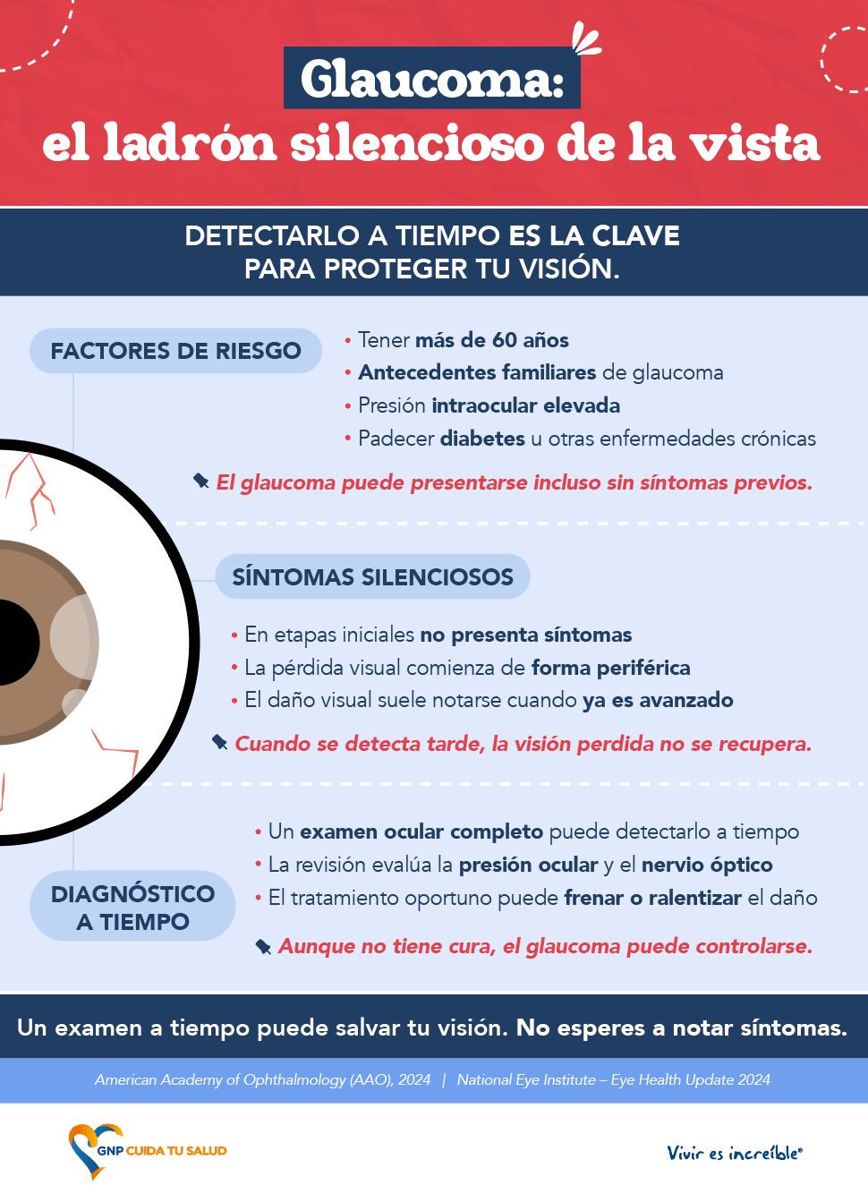 Glaucoma: el ladrón silencioso de la vista